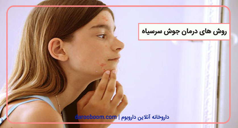 روش های درمان جوش سر سیاه