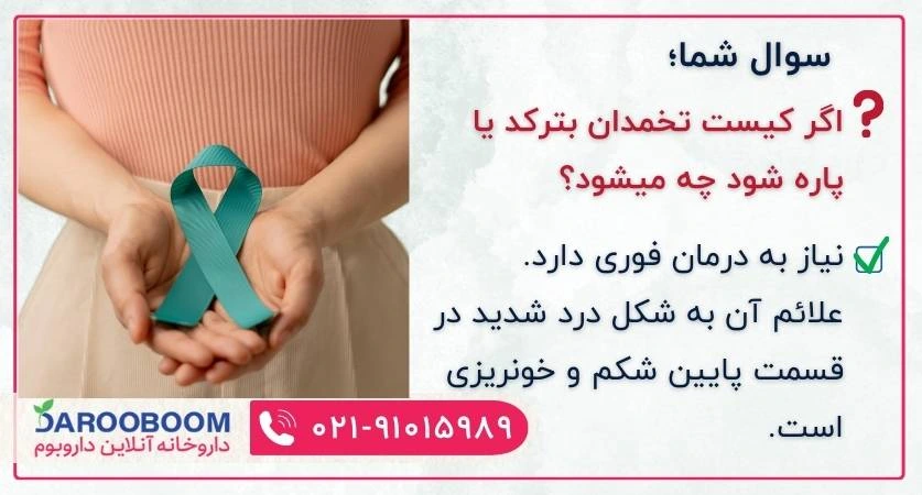 پارگی کیست تخمدان