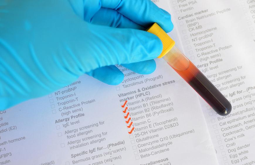 آزمایش چکاپ ویتامین بدن چیست و چه کاربردی دارد؟ داروخانه آنلاین داروبوم