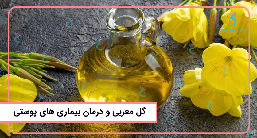 کپسول گل مغربی برای پوست