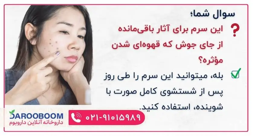 سرم روشن کننده و ویتامین سی پریم برای از بین بردن لک جای جوش